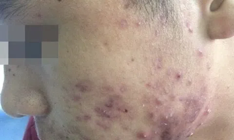 Vỡ mộng làm đẹp bằng mỹ phẩm “hàng hiệu” giá bèo